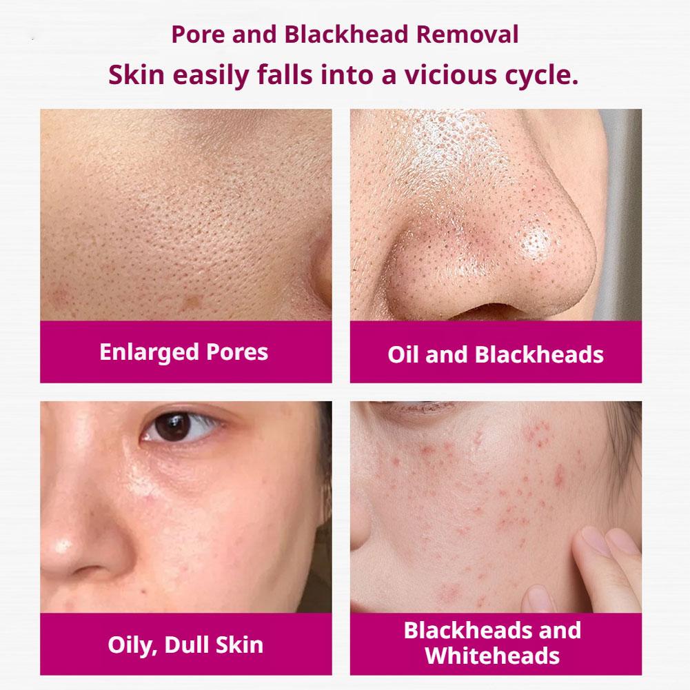 Salicylic Acid Shrink Pores Se - огляд і ціна Azelaic Acid Serum