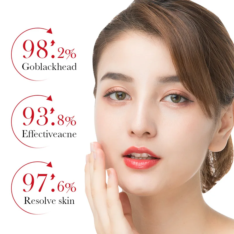 BIOAQUA Salicylic Acid Acne Re - огляд і ціна Azelaic Acid Serum