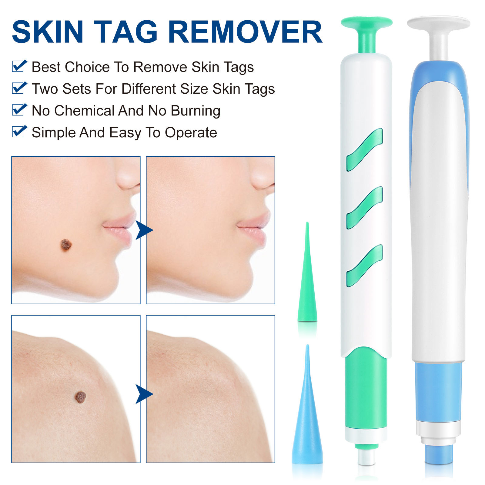 2-IN-1 Auto Skin Tag Removal K - огляд і ціна Skincare Ingredients Checker
