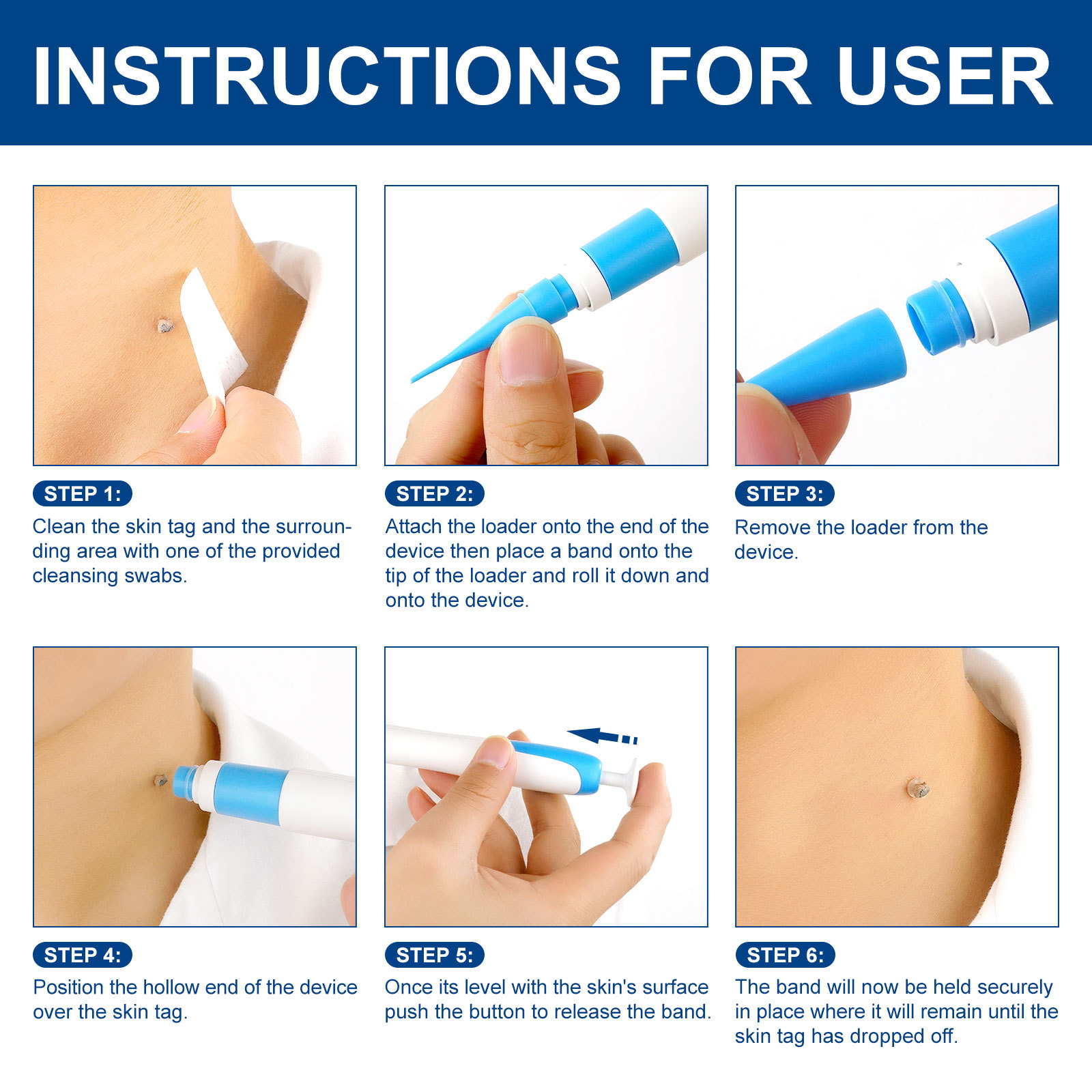 2-IN-1 Auto Skin Tag Removal K - огляд і ціна Skincare Ingredients Checker